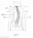 Fig. 02 - Skeletal manipulation method