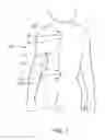 Fig. 12 - Skeletal manipulation method