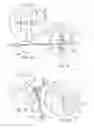 Fig. 09 - Systems and methods for posterior dynamic stabilization of the spine