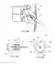 Fig. 32 - Systems and methods for posterior dynamic stabilization of the spine