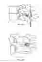Fig. 34 - Systems and methods for posterior dynamic stabilization of the spine