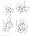 Fig. 35 - Systems and methods for posterior dynamic stabilization of the spine