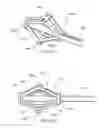 Fig. 40 - Systems and methods for posterior dynamic stabilization of the spine
