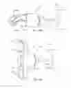 Fig. 43 - Systems and methods for posterior dynamic stabilization of the spine