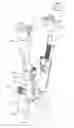 Fig. 01 - Reduction jack for spinal rod placement and method of use
