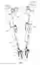 Fig. 04 - Reduction jack for spinal rod placement and method of use