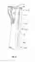 Fig. 09 - Reduction jack for spinal rod placement and method of use