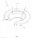Fig. 02 - Force distribution implant, assembly and kit