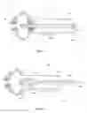 Fig. 22 - Expandable support device and method of use