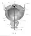 Fig. 03 - BLADDER TREATMENT BY ABLATIVE DENERVATION