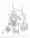 Fig. 02 - Damping a telesurgical system