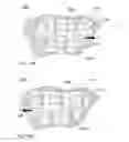 Fig. 09 - Illuminating surgical device