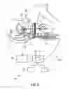 Fig. 07 - Imaging apparatus for brachytherapy or biopsy
