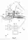 Fig. 08 - Imaging apparatus for brachytherapy or biopsy