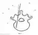 Fig. 10 - System and methods for intraoperative guidance feedback
