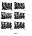 Fig. 22 - System and methods for intraoperative guidance feedback