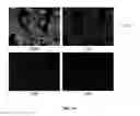 Fig. 24 - System and methods for intraoperative guidance feedback