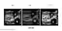 Fig. 26 - System and methods for intraoperative guidance feedback