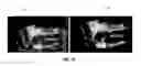 Fig. 27 - System and methods for intraoperative guidance feedback