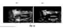 Fig. 28 - System and methods for intraoperative guidance feedback