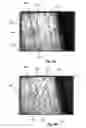Fig. 06 - Robotic hair transplantation system with touchscreen interface for controlling movement of tool
