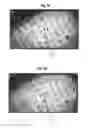 Fig. 11 - Robotic hair transplantation system with touchscreen interface for controlling movement of tool