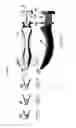 Fig. 21 - Dental wedge