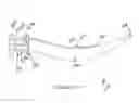Fig. 28 - Dental wedge