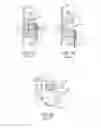 Fig. 02 - Static self-ligating orthodontic bracket and method of using same