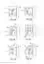 Fig. 06 - Static self-ligating orthodontic bracket and method of using same