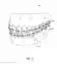Fig. 07 - Static self-ligating orthodontic bracket and method of using same