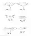 Fig. 08 - METHOD AND ARTICLES FOR TREATMENT OF STRESS URINARY INCONTINENCE
