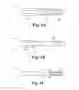 Fig. 09 - METHOD AND ARTICLES FOR TREATMENT OF STRESS URINARY INCONTINENCE