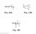 Fig. 11 - METHOD AND ARTICLES FOR TREATMENT OF STRESS URINARY INCONTINENCE