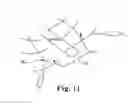Fig. 12 - METHOD AND ARTICLES FOR TREATMENT OF STRESS URINARY INCONTINENCE