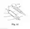 Fig. 13 - METHOD AND ARTICLES FOR TREATMENT OF STRESS URINARY INCONTINENCE