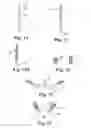 Fig. 15 - METHOD AND ARTICLES FOR TREATMENT OF STRESS URINARY INCONTINENCE