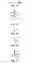 Fig. 16 - METHOD AND ARTICLES FOR TREATMENT OF STRESS URINARY INCONTINENCE