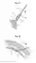Fig. 05 - Implantable Reinforcement Prothesis, In Particular for Reinforcing the Abdominal Wall