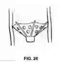 Fig. 22 - FILTERS WITH ECHOGENIC CHARACTERISTICS
