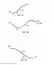 Fig. 06 - ENDOLUMINAL FILTER HAVING ENHANCED ECHOGENIC PROPERTIES