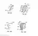 Fig. 08 - ENDOLUMINAL FILTER HAVING ENHANCED ECHOGENIC PROPERTIES