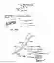 Fig. 21 - ENDOLUMINAL FILTER HAVING ENHANCED ECHOGENIC PROPERTIES