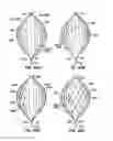 Fig. 29 - ENDOLUMINAL FILTER HAVING ENHANCED ECHOGENIC PROPERTIES