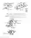 Fig. 50 - ENDOLUMINAL FILTER HAVING ENHANCED ECHOGENIC PROPERTIES