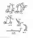 Fig. 61 - ENDOLUMINAL FILTER HAVING ENHANCED ECHOGENIC PROPERTIES