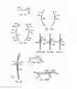 Fig. 62 - ENDOLUMINAL FILTER HAVING ENHANCED ECHOGENIC PROPERTIES