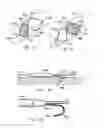 Fig. 63 - ENDOLUMINAL FILTER HAVING ENHANCED ECHOGENIC PROPERTIES