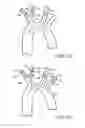Fig. 03 - Embolic protection during percutaneous heart valve replacement and similar procedures