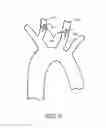 Fig. 06 - Embolic protection during percutaneous heart valve replacement and similar procedures